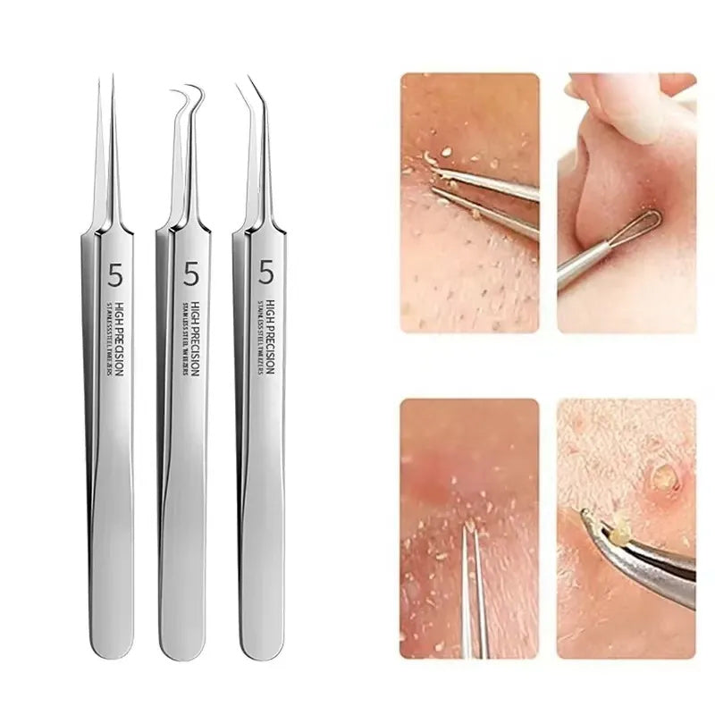 3 in 1 Akne-Nadel