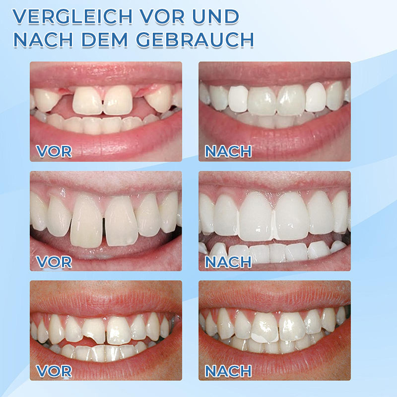 Fester Zahnrestauration-Kleber