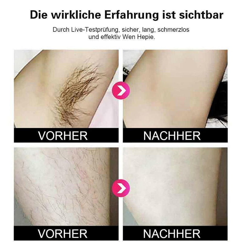 schneller sanfter Tweez Haarentferner